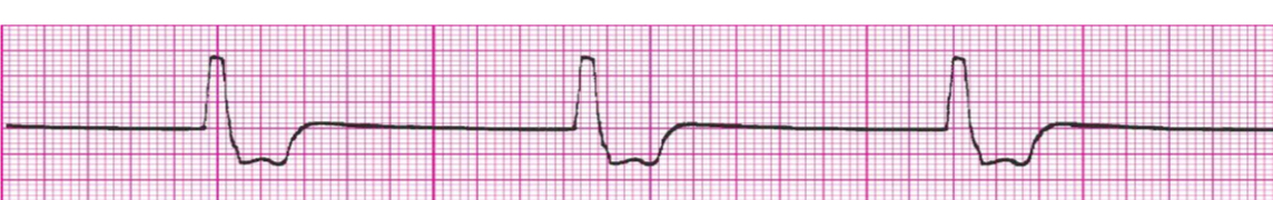 <p>What’s the rhythm?</p>