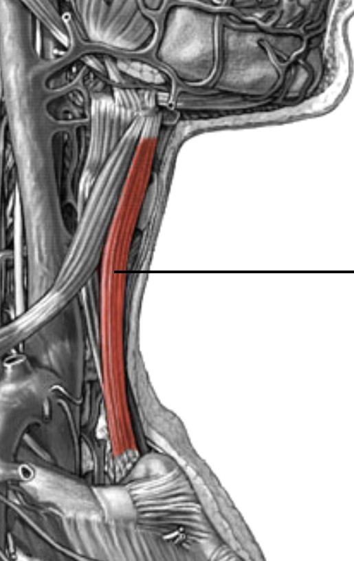 <p>Which anterior muscle of the neck is:</p><ul><li><p>Attach to sternum &amp; hyoid</p></li><li><p>Action: depress hyoid to stabilize</p></li><li><p>Nerve: <span style="color: yellow;">C1-C3</span> nerve roots</p></li></ul><p></p>