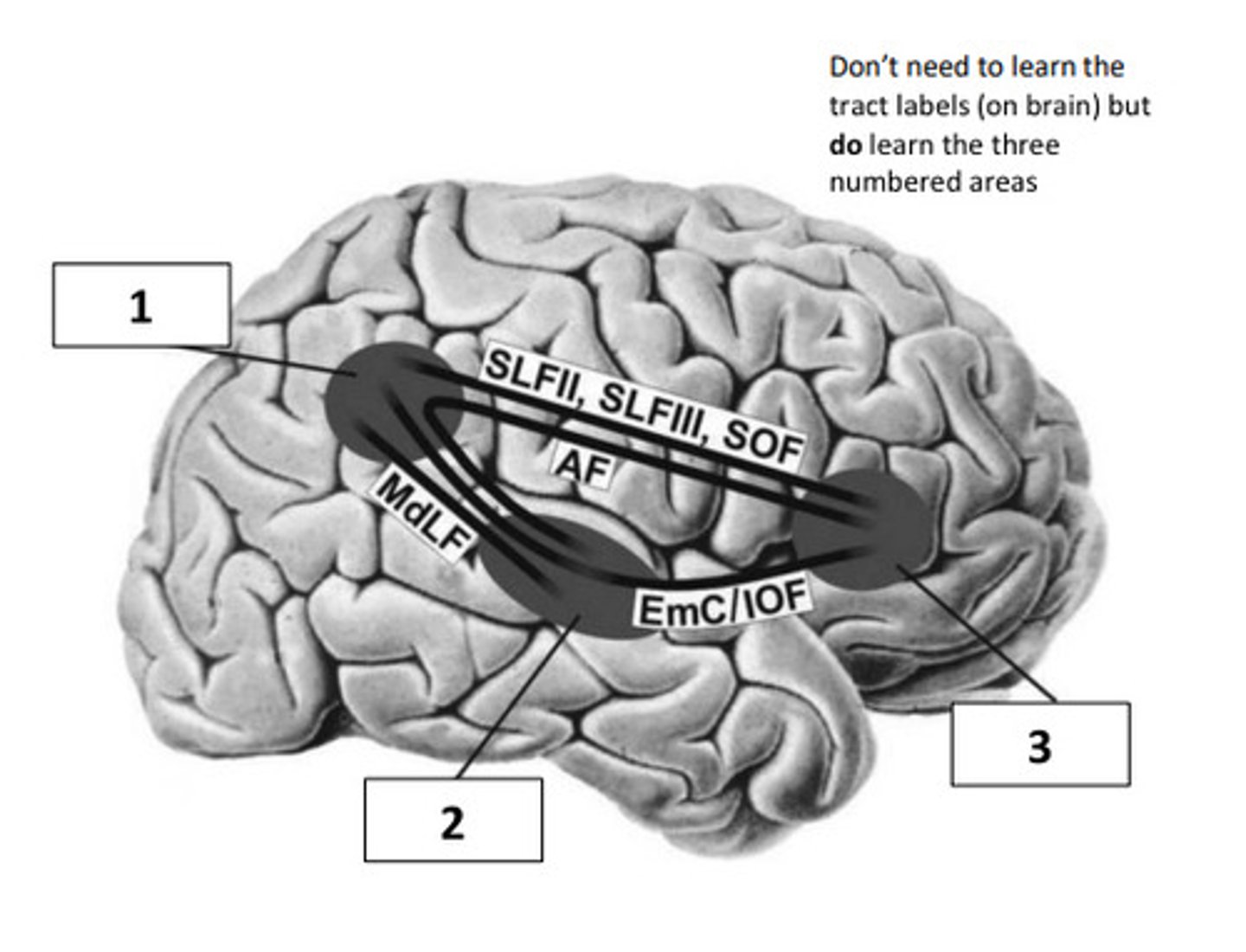 <p>all in right hemisphere, 3 major cortical areas</p><p>1. inferior parietal lobe and temporo-parietal junction</p><p>2. superior temporal gyrus</p><p>3. ventral frontal cortex</p><p>*damage to white-matter tracts connecting the 3 areas can also lead to neglect</p>