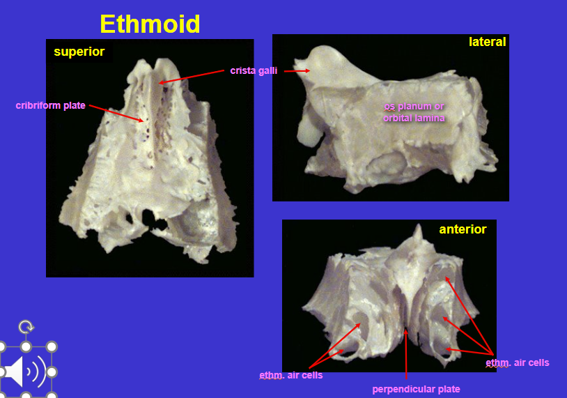 <p>Ethmoid bone (visible from orbit)</p><ul><li><p>surrounds cribriform plate &amp; crista galli</p></li></ul><p></p>