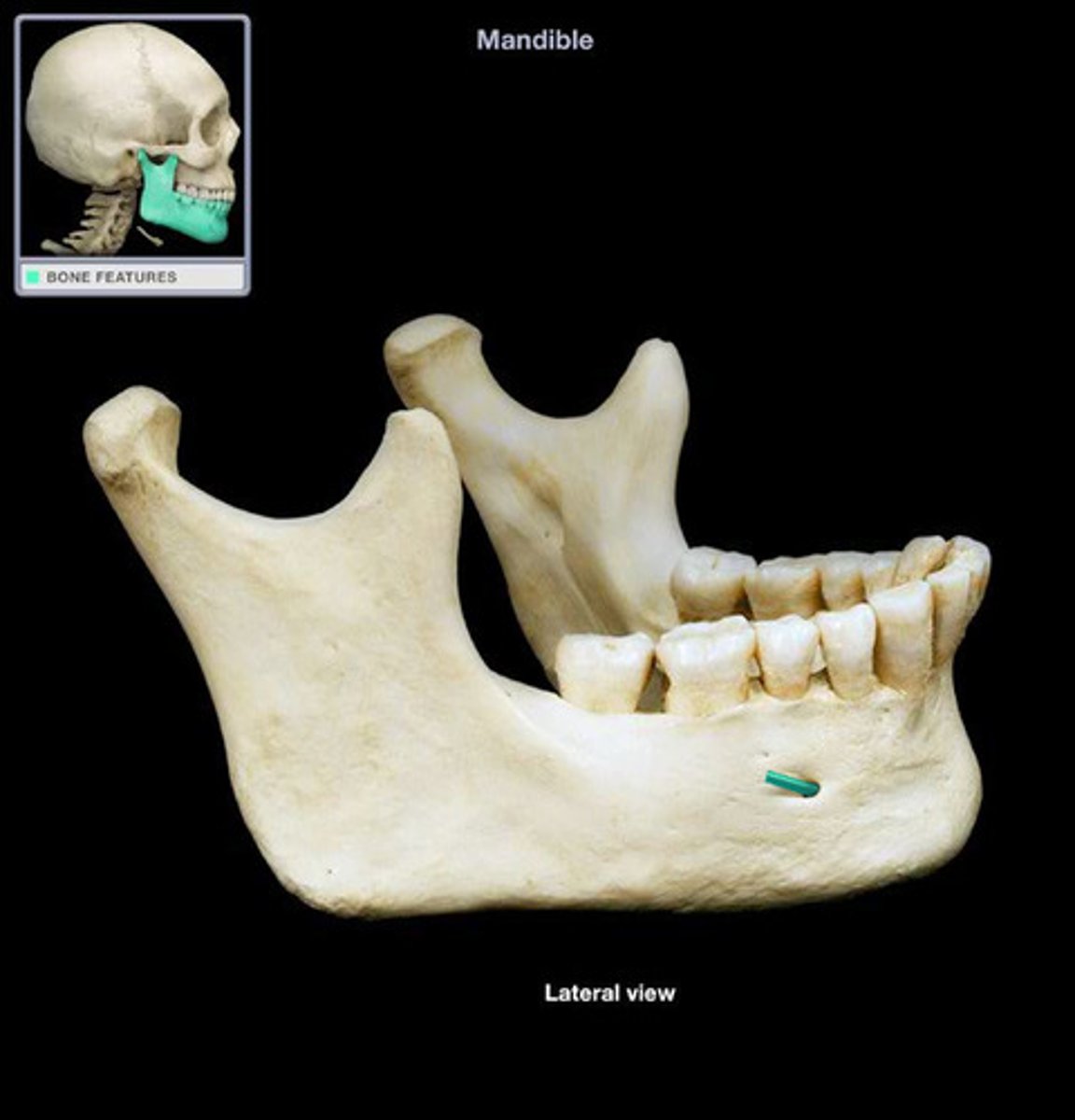 <p>one of two holes located on the anterior surface of the mandible. It permits passage of the mental nerve and vessels.</p>