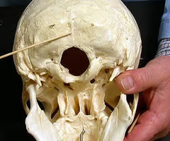 <p>extends downward from the external occipital protuberance</p>