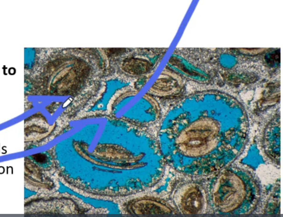 <p>Changes in T and P/pore water (water inside pore of rock) composition (porosity change)</p><p>→ dissolves minerals in solution (e.g co2 and carbonic acid)</p><p>Dissolution without re-precipitation</p><p>→ prolonged pumping of pore water w no dissolved mineral</p><p>→ stops water saturating and cement forming from precipitating</p><p>→ common in carbonates</p>