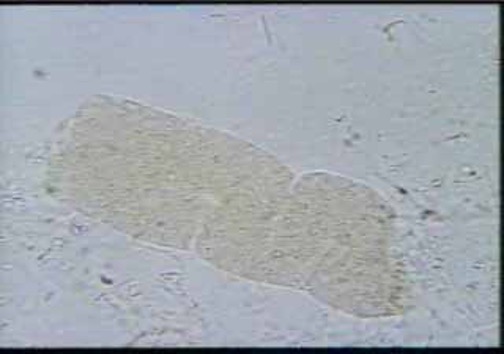 <p>Broad casts are also known as what?</p><p>what does it indicate?</p>