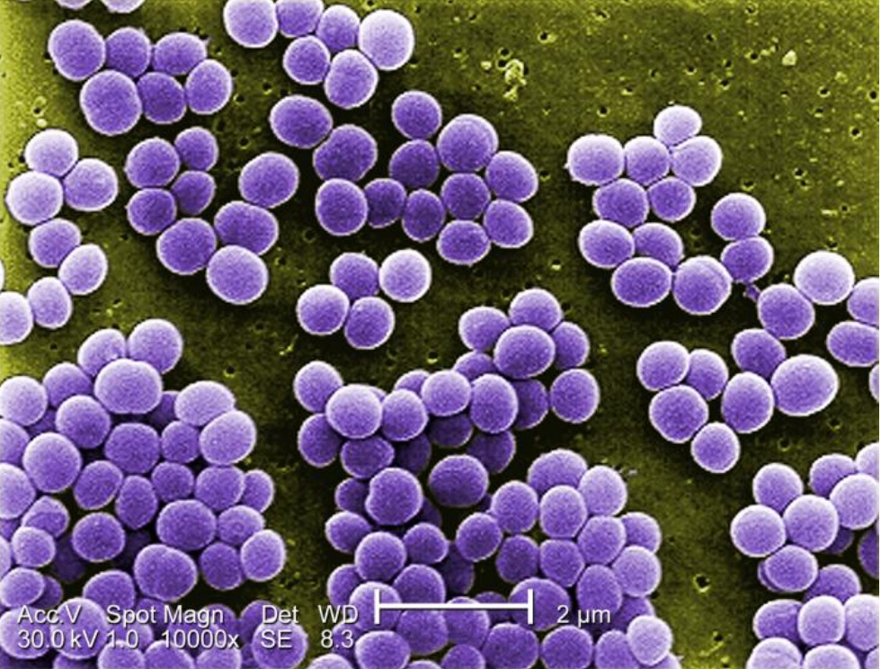 What is this pathogenic bacteria