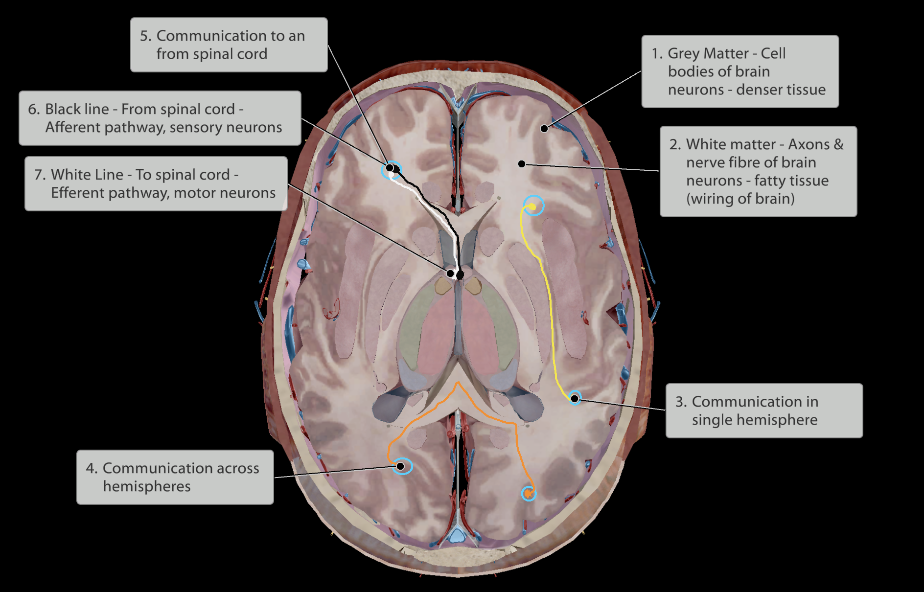 <p>Interprets and provides meaning to any sensation.</p><ul><li><p>Sends information out to inititiate movement</p><p></p></li></ul><p><strong><em><u>Grey Matter: </u></em></strong>Cell bodies of brain neurons</p><p><strong><em><u>White Matter:</u></em></strong> Fatty, axons that connect and facilitate communication between brain neurons, the wiring of the brain.</p>