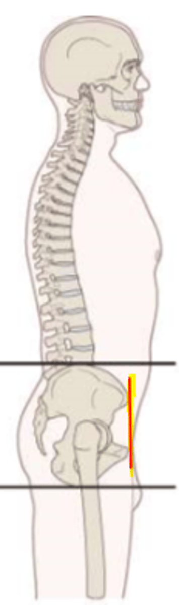 <p>ASIS and pubic symphysis are oriented vertically</p>