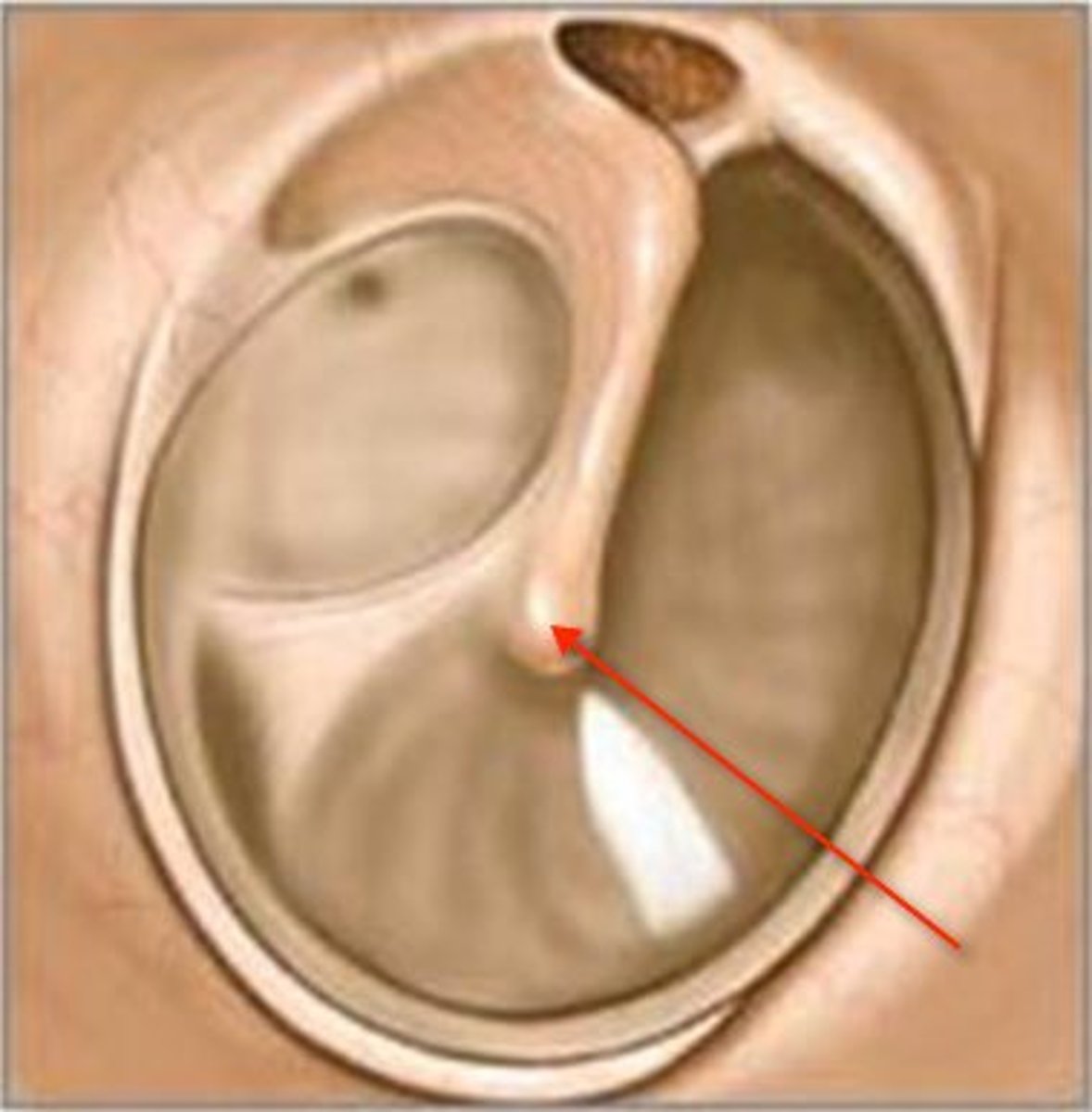<p>where handle of the malleus attaches to tympanic membrane, drawing the eardrum slightly inward in a cone shape</p>