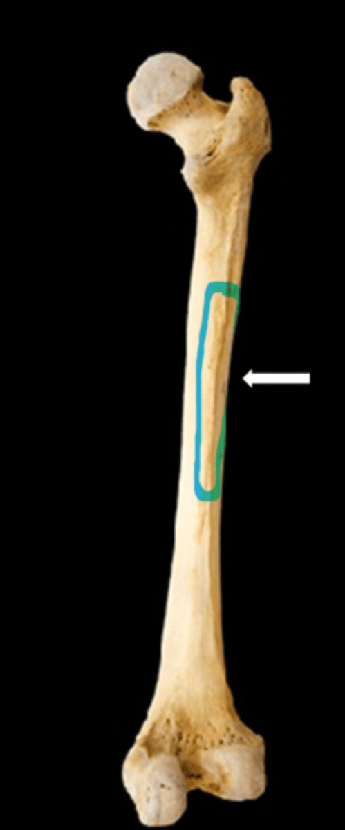 <p>name the part</p>