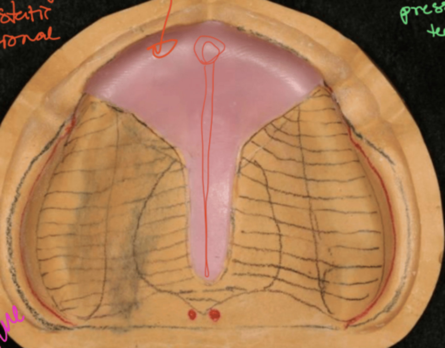 <p>what technique is being used</p>