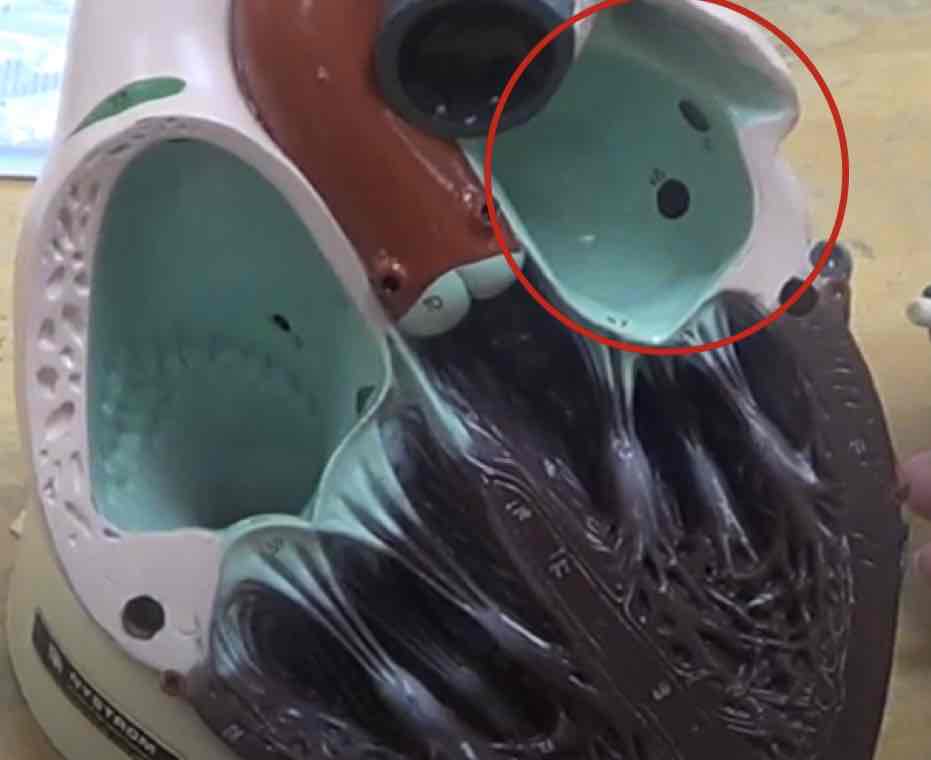 <p>what is this? (giant heart model)</p>