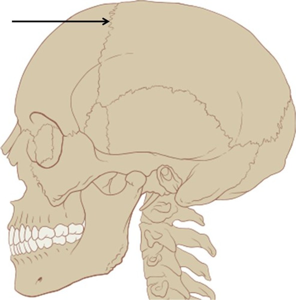 <p>between frontal and parietal bones</p>