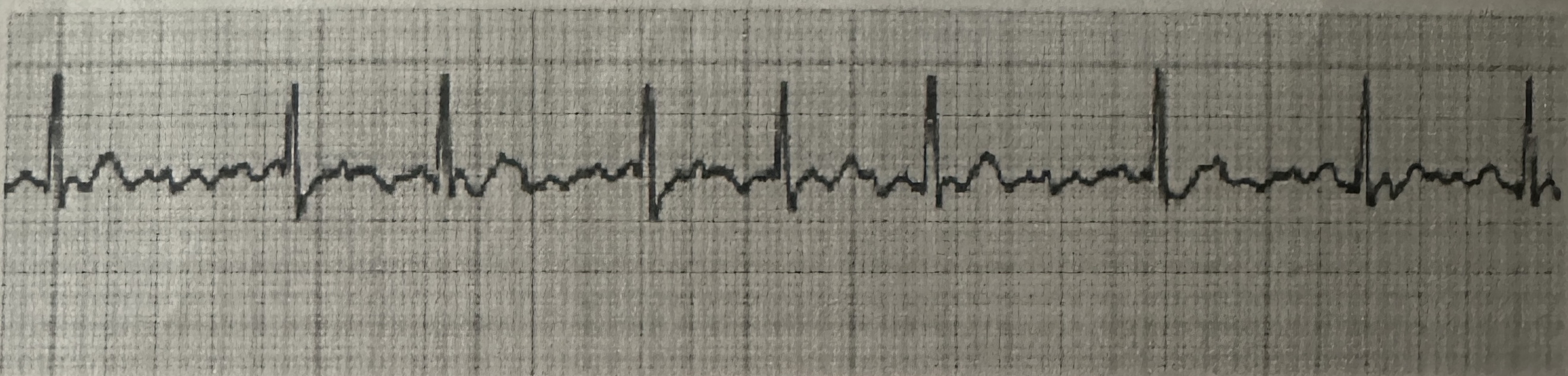 <p>identify this rhythm</p>
