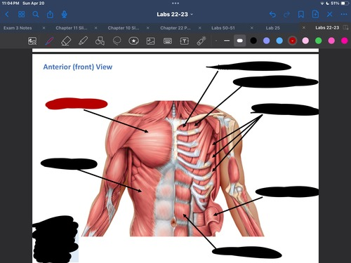 <p>What muscle is this?</p>