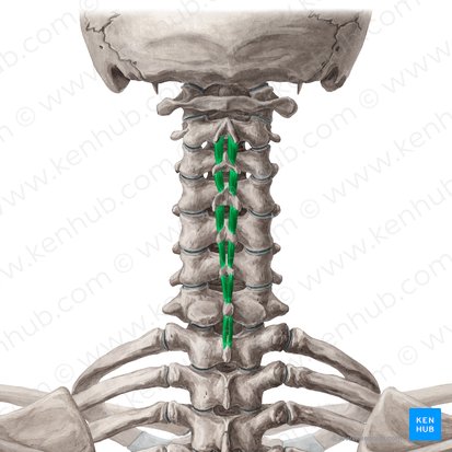 <p>what msucle is this </p><p>spinous process to spinous process </p><p>aid in extension and rotation</p>