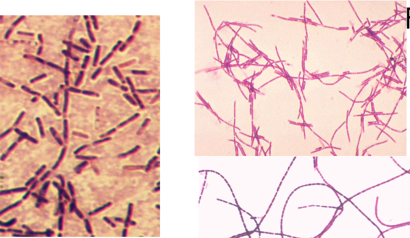 <p>Gram Positive Rod</p>