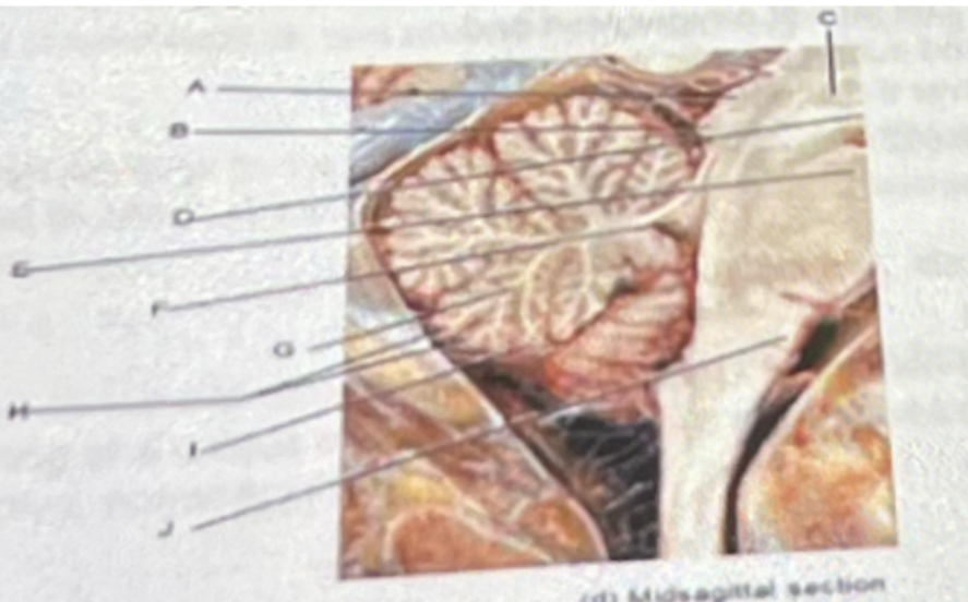 <p>A B and C above represent</p><p>A- Pons</p><p>B- cerebellum </p><p>C- midbrain </p><p>D- hippocampus </p><p>E- hypothalamus</p>