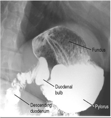 <p>What position is this patient in?</p>