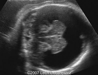 <p>What is this an image of?</p>