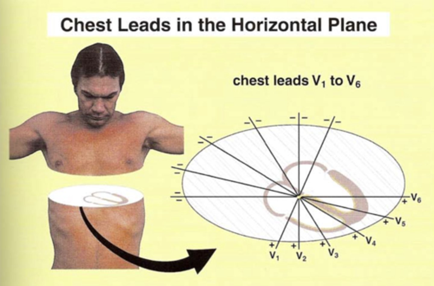 <p>Chest leads look at the heart in the horizontal plane.</p><p>Each lead (positive) is oriented through AV node and projects through the patient’s back (negative)</p>