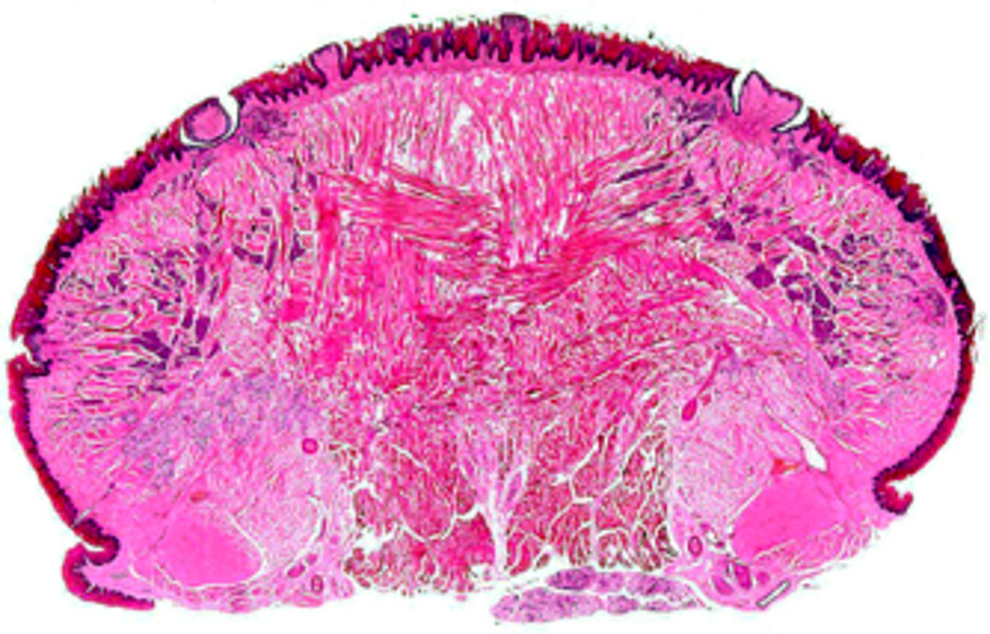<p><em>identify the mucosa:</em></p>