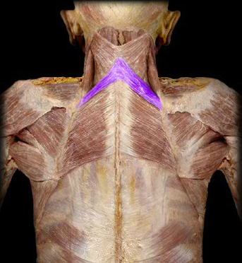<p>Identify</p>