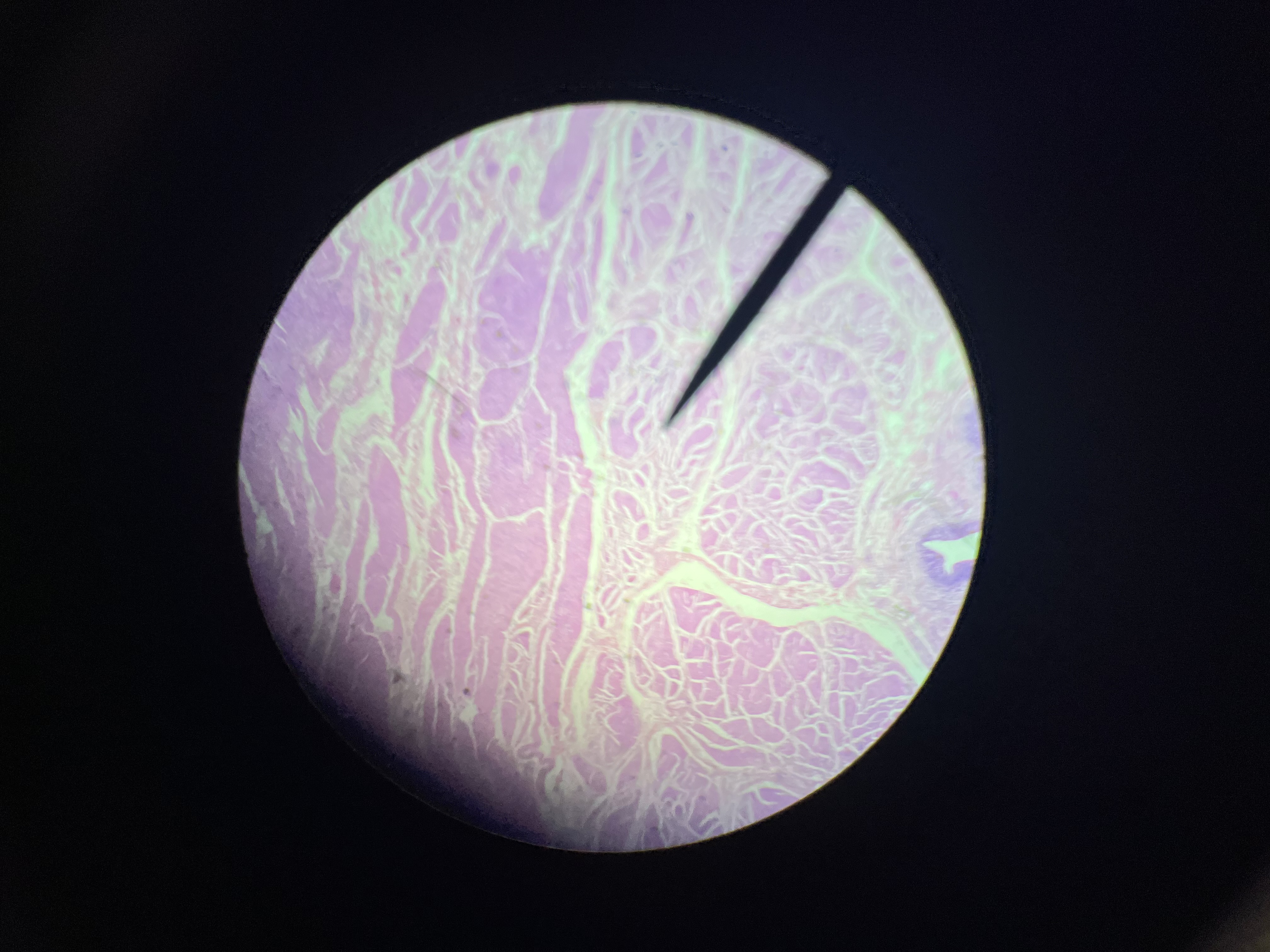 <p>in the urinary bladder; they help to acomodate fluctuations in volume of fluid</p>