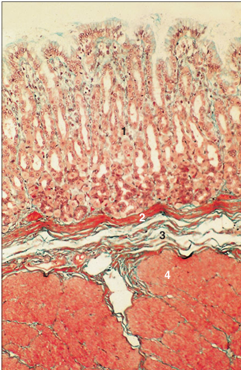 <p>Identify the structure:</p><p>Specie:</p><p>Parts:</p><p>1.__ 2.__ 3.__ 4.__ </p><p>Stain used:</p>