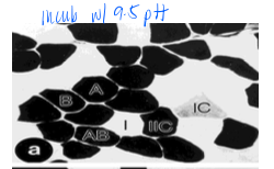<p>pH which resulted in stronger staining of fast muscle fibers (Type II)</p>