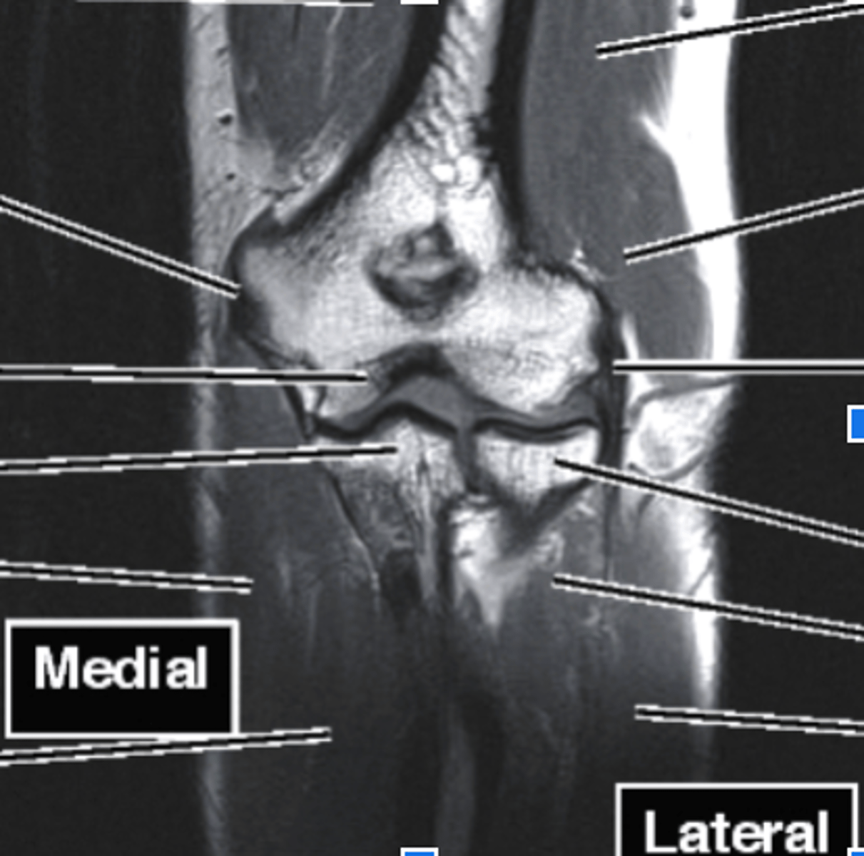<p>what type of imaging is this?</p>