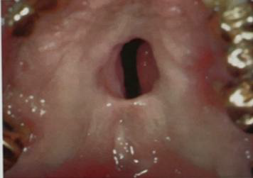 <ul><li><p>Identify the disease</p></li><li><p>Clinical feature</p></li></ul><p></p>