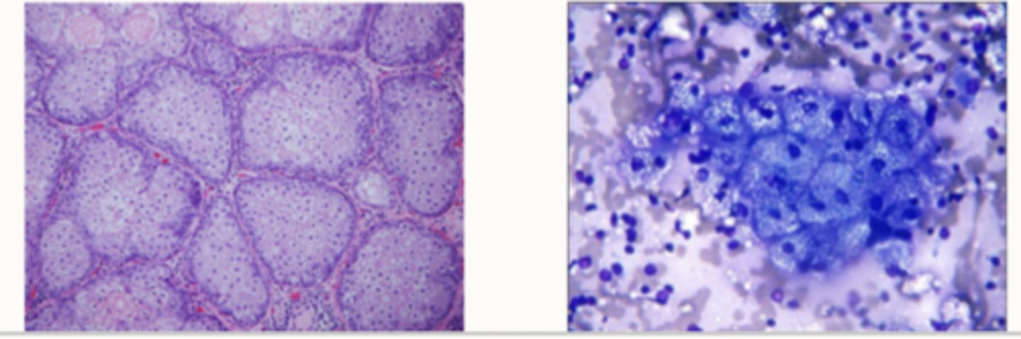 <p>What cell type are these</p>