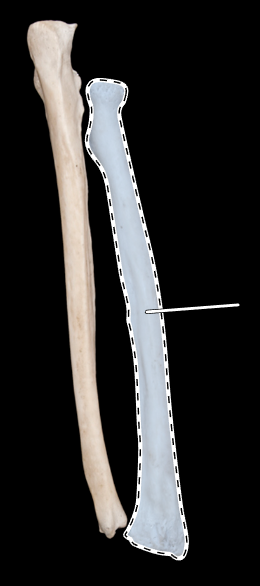 <p>Name this bone.</p><p>(Posterior view).</p>
