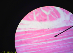 <p>Location: found attached to bones</p>
