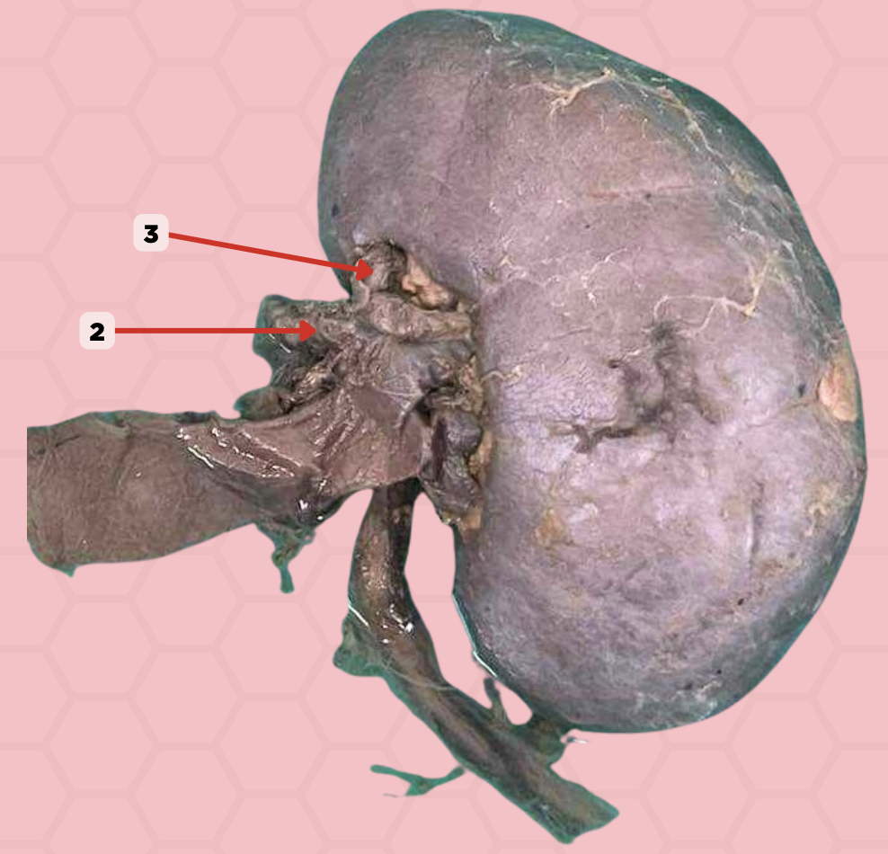 <p>How many branches will pin no. 2 have as it approaches the hilum of the kidney?</p><p>a. nine</p><p>b. seven</p><p>c. five</p><p>d. three</p>