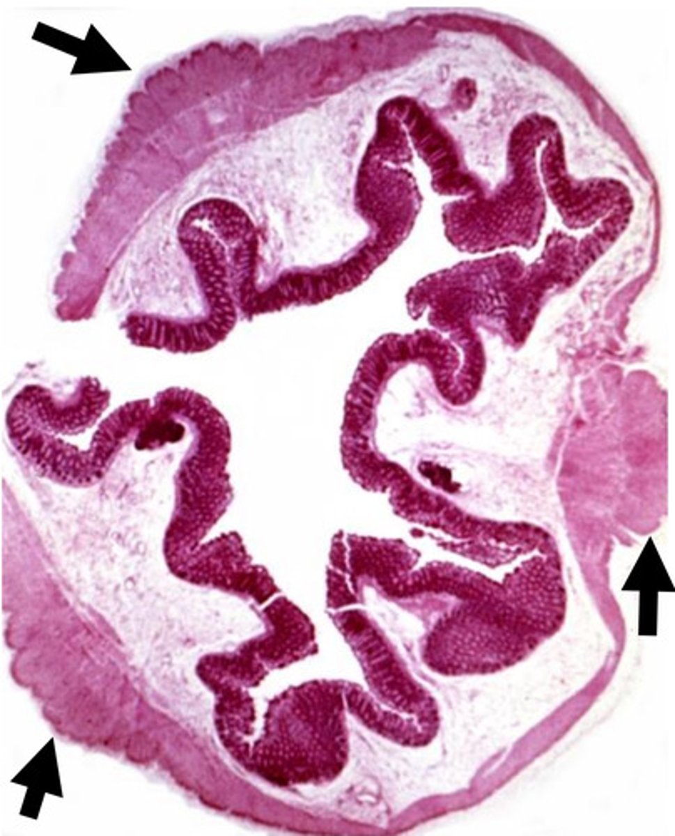 <p>taenia coli</p>