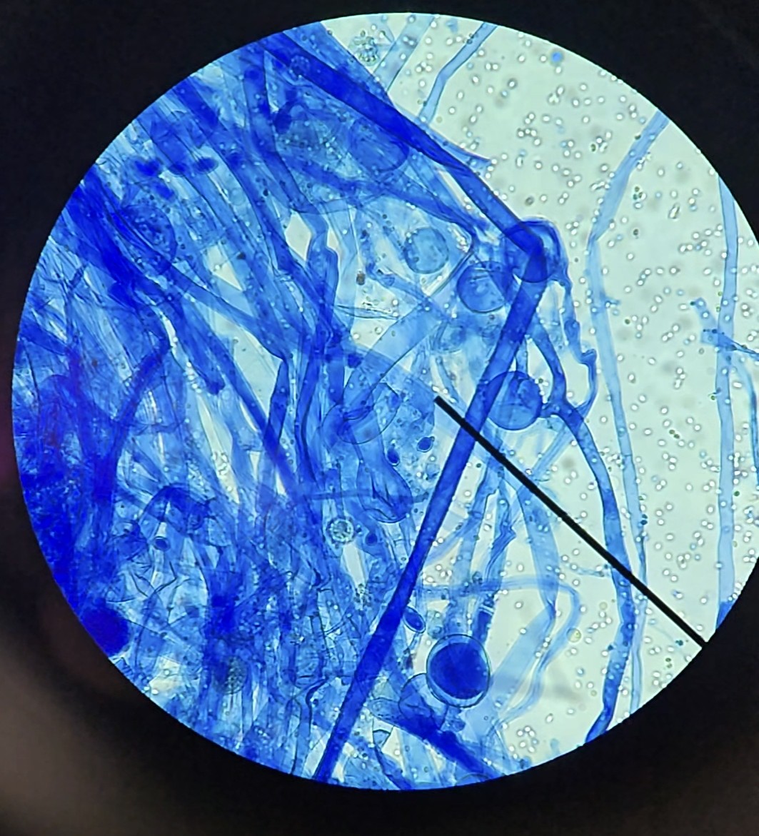 <p>Identify this fungus</p>