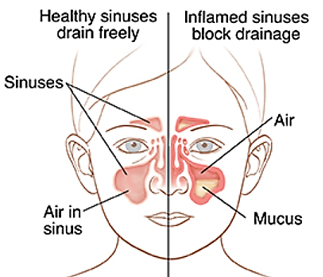 <p>Maxillary sinus</p>