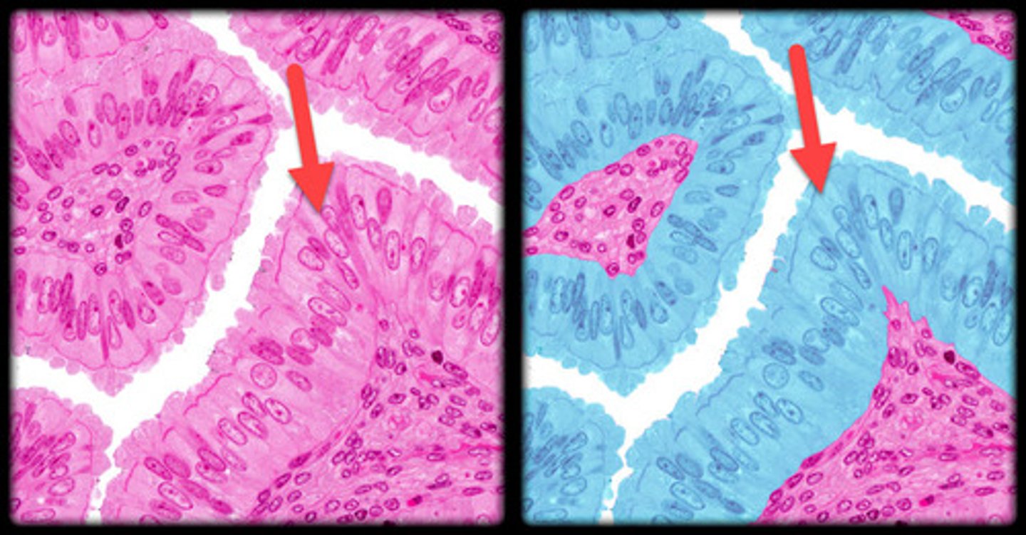 <p>- Single layer of tall, column-like cells.</p><p>- Nuclei are oval and located near the basal end.</p><p>- Cilia on the surface create a fuzzy appearance under the microscope.</p><p>- Found in the respiratory tract and uterine tubes, where cilia help move substances.</p>