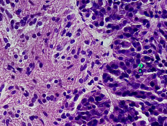 <p><span><span>Identify the indicated region of the pituitary gland.</span></span></p>
