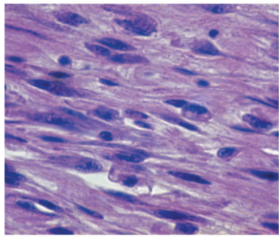 <p><span>cells that <strong><mark data-color="initial" style="background-color: initial; color: inherit">create and maintain connective tissues, which support and connect organs and tissues</mark></strong>. They also play a role in wound healing.&nbsp;</span></p>