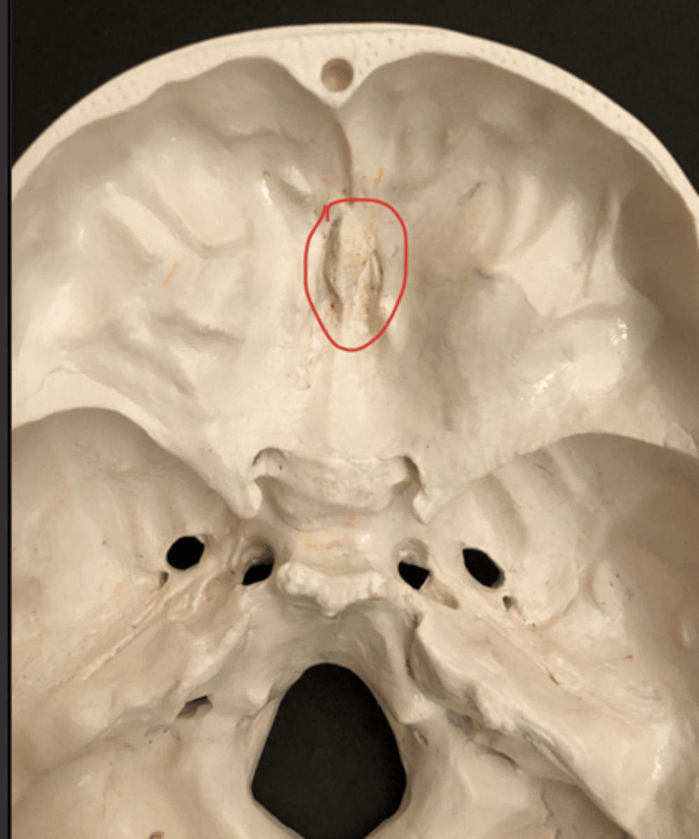 <p>Area Surrounding the protrusion</p>