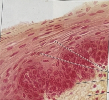 <p>Stratified squamous</p>