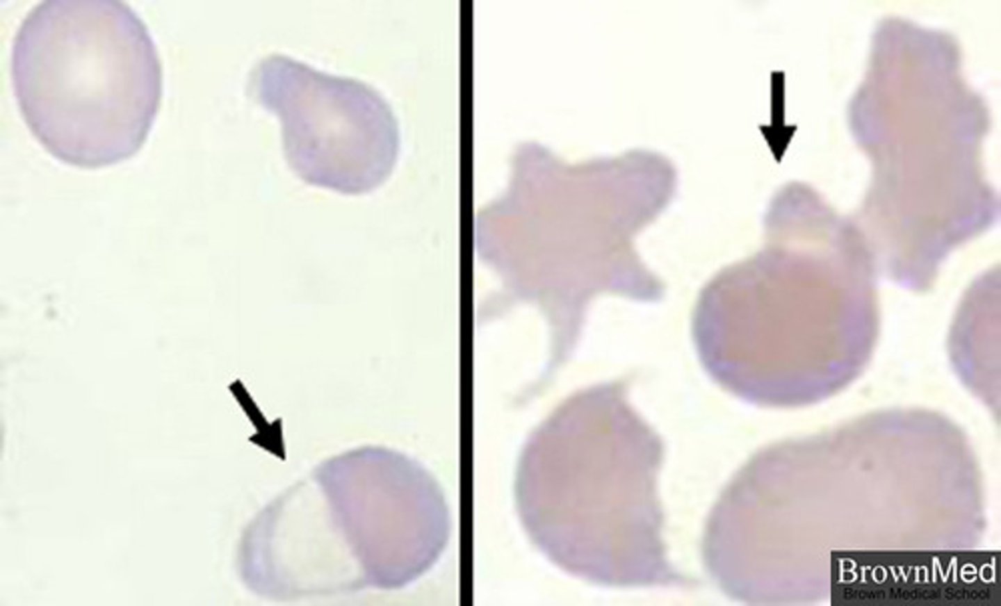 <p>large bubble on the edge of the cell</p>