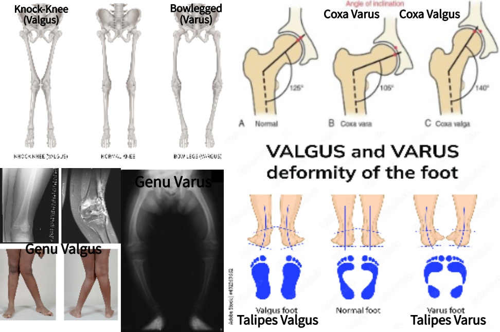 Structural Kinesiology Exam 1 Flashcards Knowt