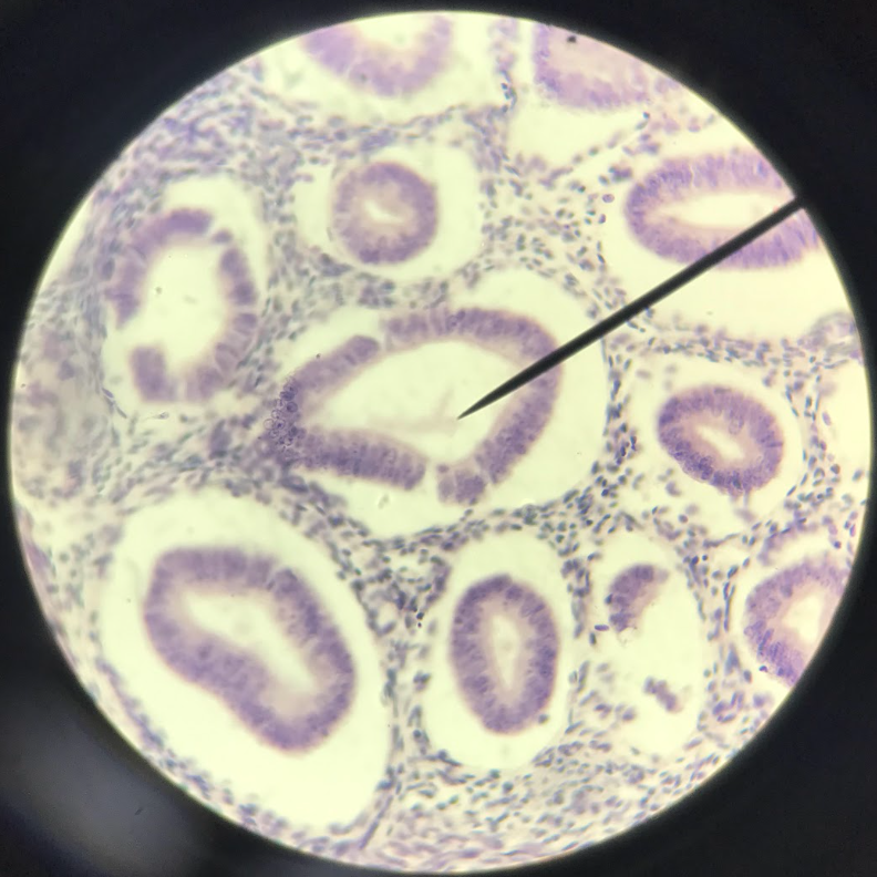 <p>on the free surface of the epithelial cells are ultrastructures, like the <strong>cilia</strong>, that helped the tissue in moving materials over it</p>