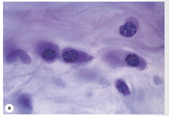 <p>Heterochromatino gumbureliai</p>