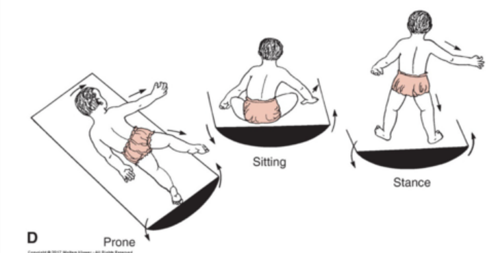 <ul><li><p><strong>stimulus</strong>: tilt baby while in appropriate position</p></li><li><p><strong>rxn</strong>: curve spine toward raised side, abduction/extension of arms and legs</p></li><li><p><strong><mark data-color="blue" style="background-color: blue; color: inherit">types:</mark></strong></p><ol><li><p><strong>prone</strong>: 5mos</p></li><li><p><strong>supine &amp; sitting:</strong> 7-8mos</p></li><li><p><strong>quadruped</strong>: 9-12mos</p></li><li><p><strong>standing</strong>: 12-21mos</p></li></ol></li><li><p><strong>purpose</strong>: adjust center of gravity and preserve balance</p></li></ul><p></p>