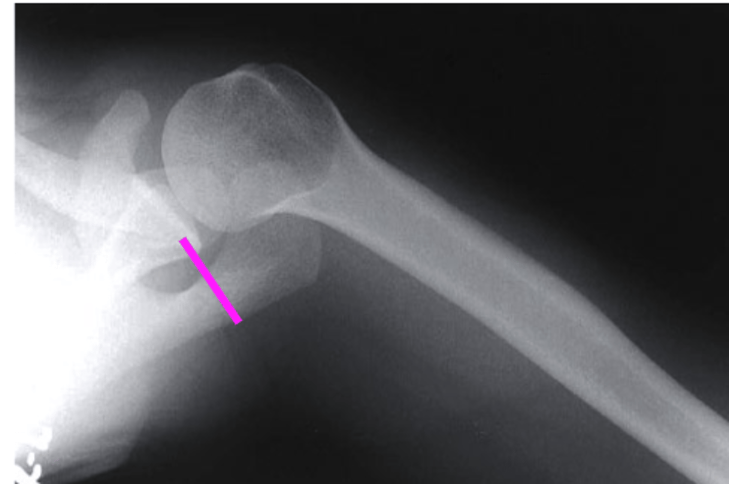 <p>what does the pink line point to?</p>