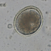 <p>roundworm that infects cats</p>